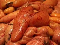 Is Liver Disease Hereditary?