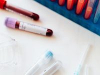 Rapid DNA Hematology Analyzers Revolutionize the Process